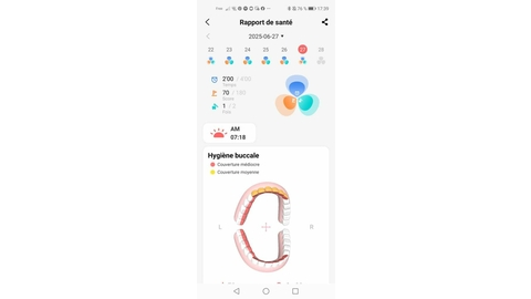 Oclean X Pro 20 Bildschirm