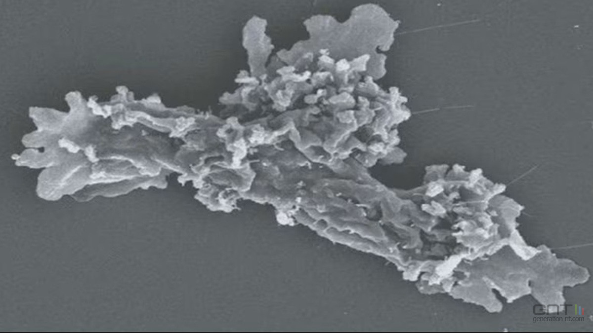 Incroyable découverte : l'amibe du feu qui défie les lois de la biologie !