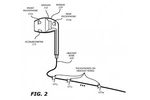 Apple earpods reduction bruit