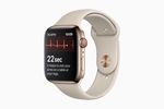 Apple-Watch-Series-4-ECG