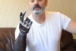 bebionic3