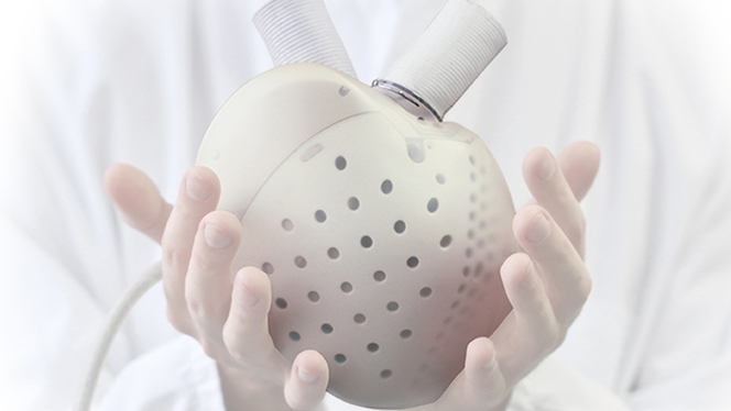 Carmat coeur artificiel Aeson