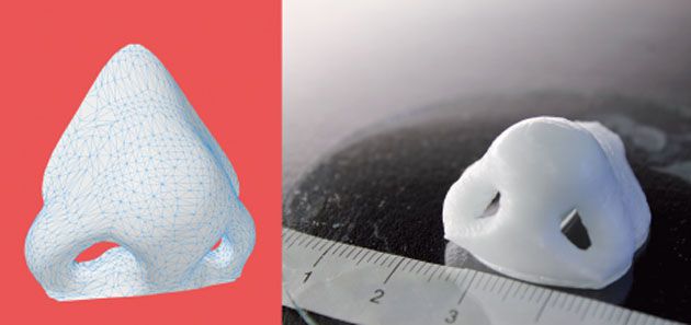 Cartilage