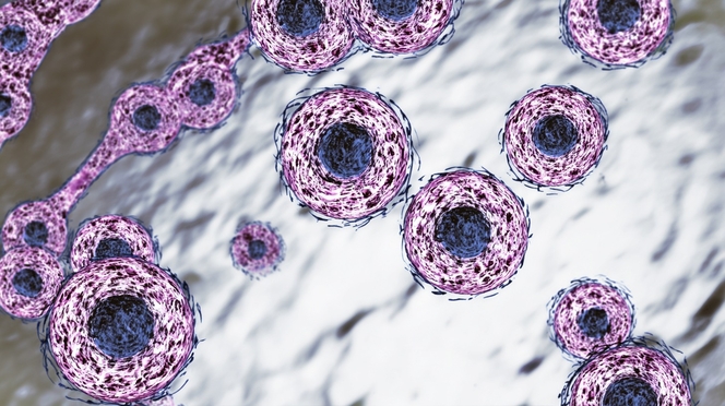 cellule cancer 02