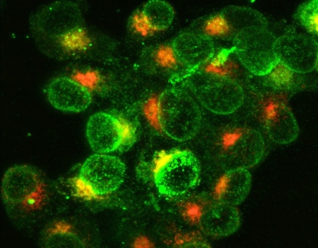 cellules alzheimer