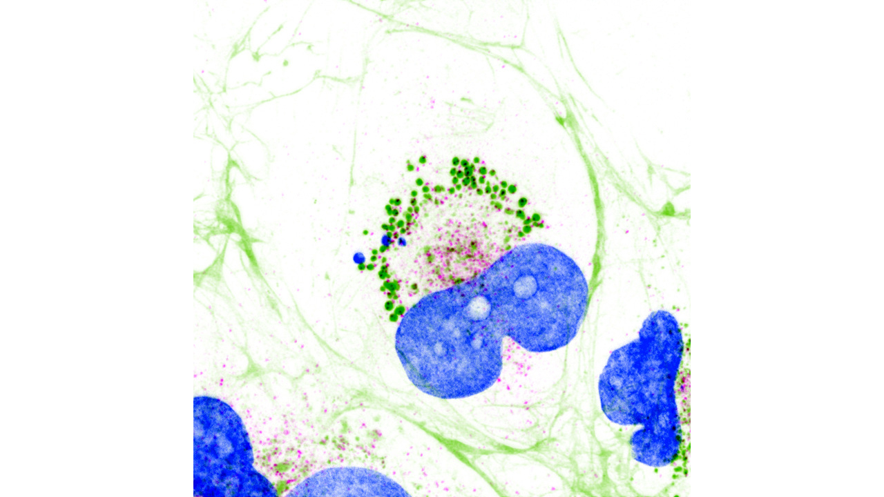 cellules-hepatiques-gouttelettes-collagene-en-vert-tango1-en-magenta