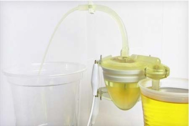 coeur robot urine