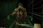 Dementium II - 7