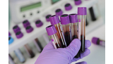 Fuite en ligne de milliers de dossiers de patients atteints du VIH (Singapour)