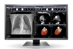 Eizo RadiForce MX315W (1)