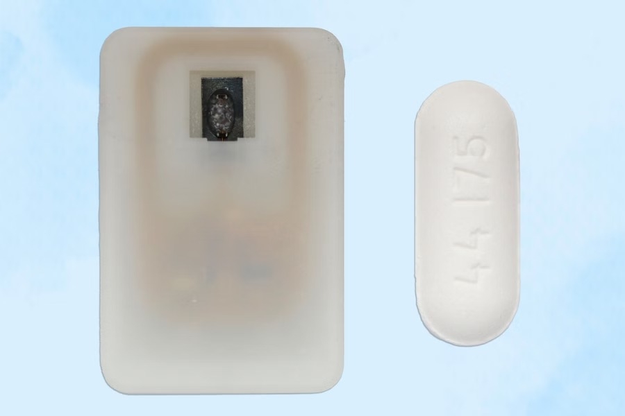 Implant diabÃ¨te 3D