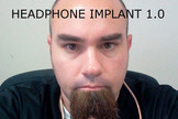 Insolite : il se fait implanter des écouteurs directement dans l'oreille