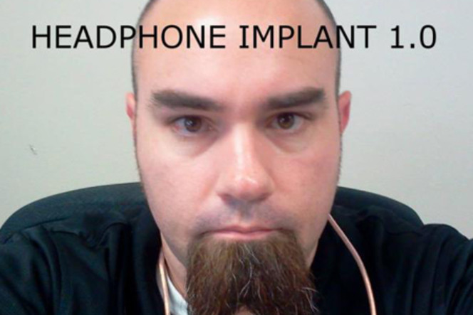 implant écouteurs