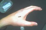 implant rfid