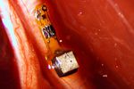implant