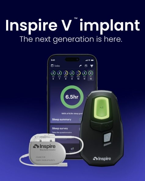 Inspire V Implant