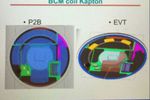 iWatch composant