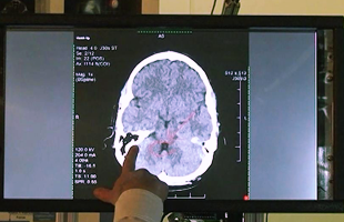 Microsoft-3D-Haptic-cerveau