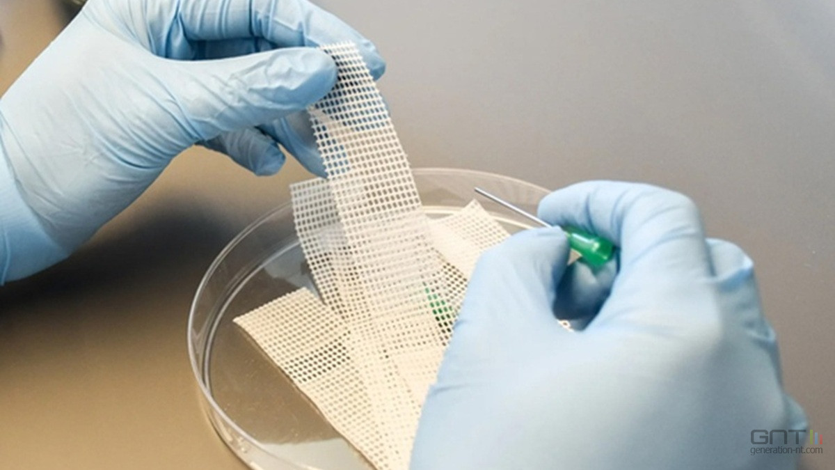 La fin des points de suture est-elle proche grâce à cette "colle" chirurgicale du MIT ?