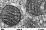 mitochondrie vignette