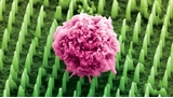 Des nano-aiguilles pourraient bientôt remplacer les biopsies douloureuses