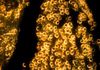 Des nanoparticules d'or pour faciliter les liposuccions