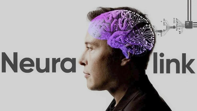 Neuralink