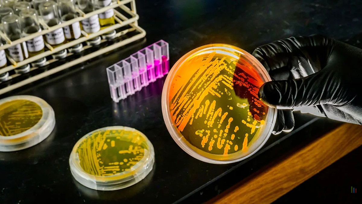 Et si Parkinson et la démence commençaient dans nos intestins ?