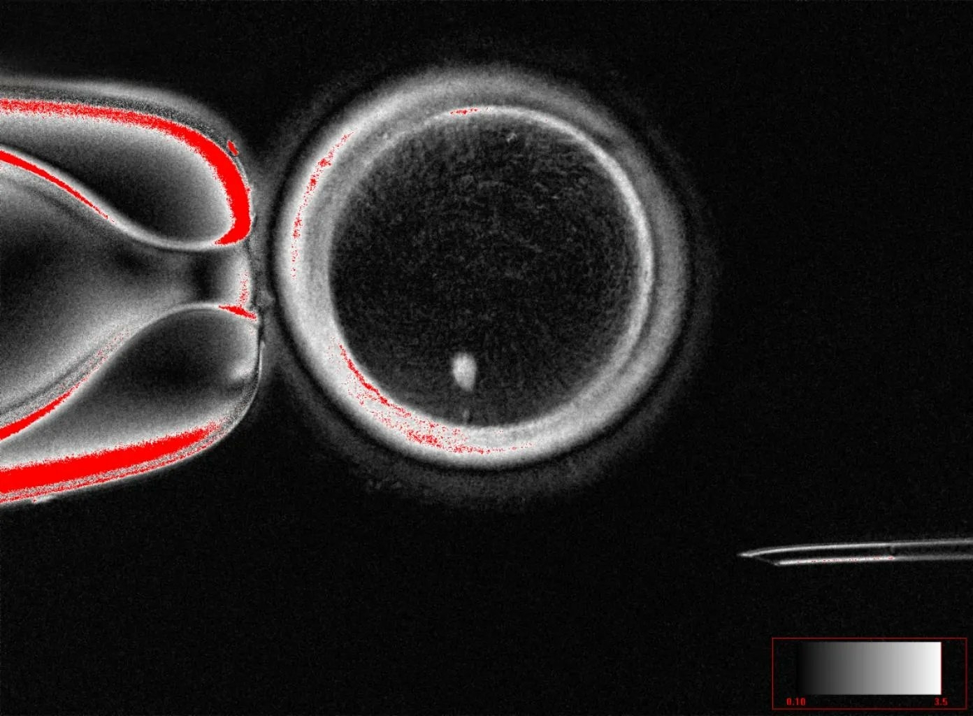 ovule et noyau de cellule de peau humaine