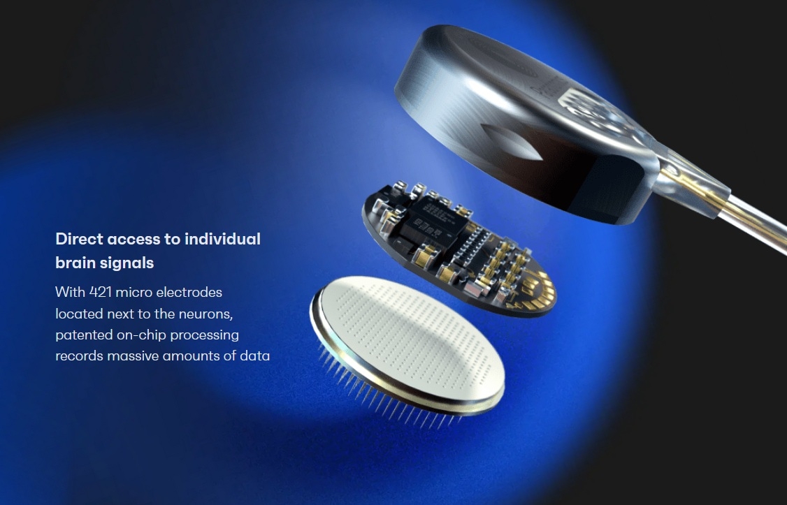 Paradromics implant cerebral electrodes