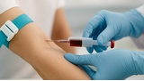 Une prise de sang détecte le cancer 3 ans avant les symptômes : l'incroyable avancée médicale !
