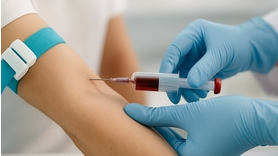 Une prise de sang détecte le cancer 3 ans avant les symptômes : l'incroyable avancée médicale !