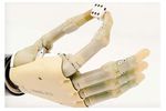 prothèse main robotique