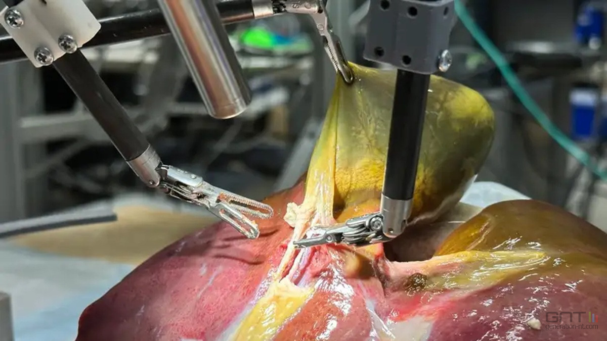 robot chirurgie autonome John Hopkins