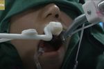 Robot dentiste