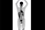Scanner 3D