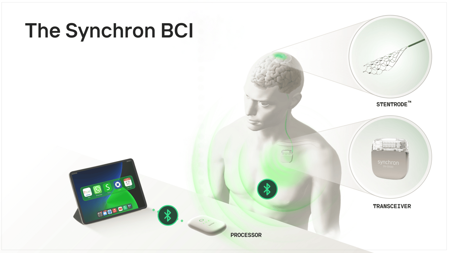 Synchron BCI