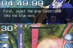 Trauma center 2 DS (3)