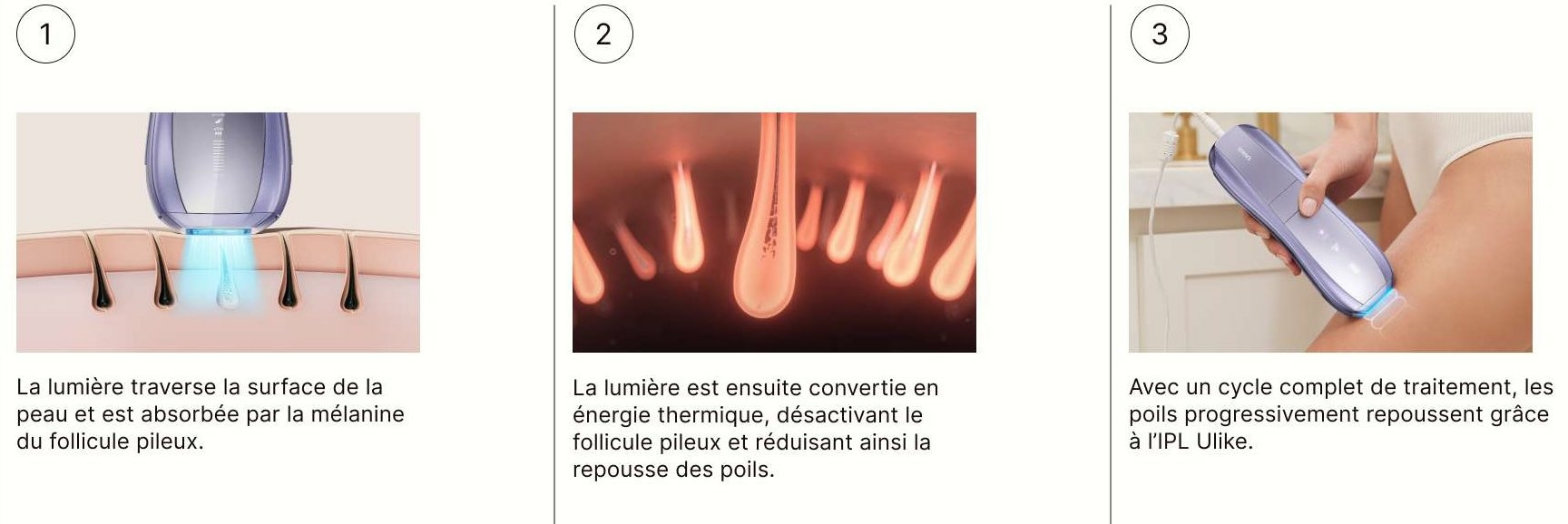 Ulike Air 10 Pro IPL