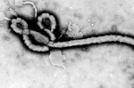 virus ebola