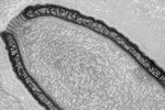 virus