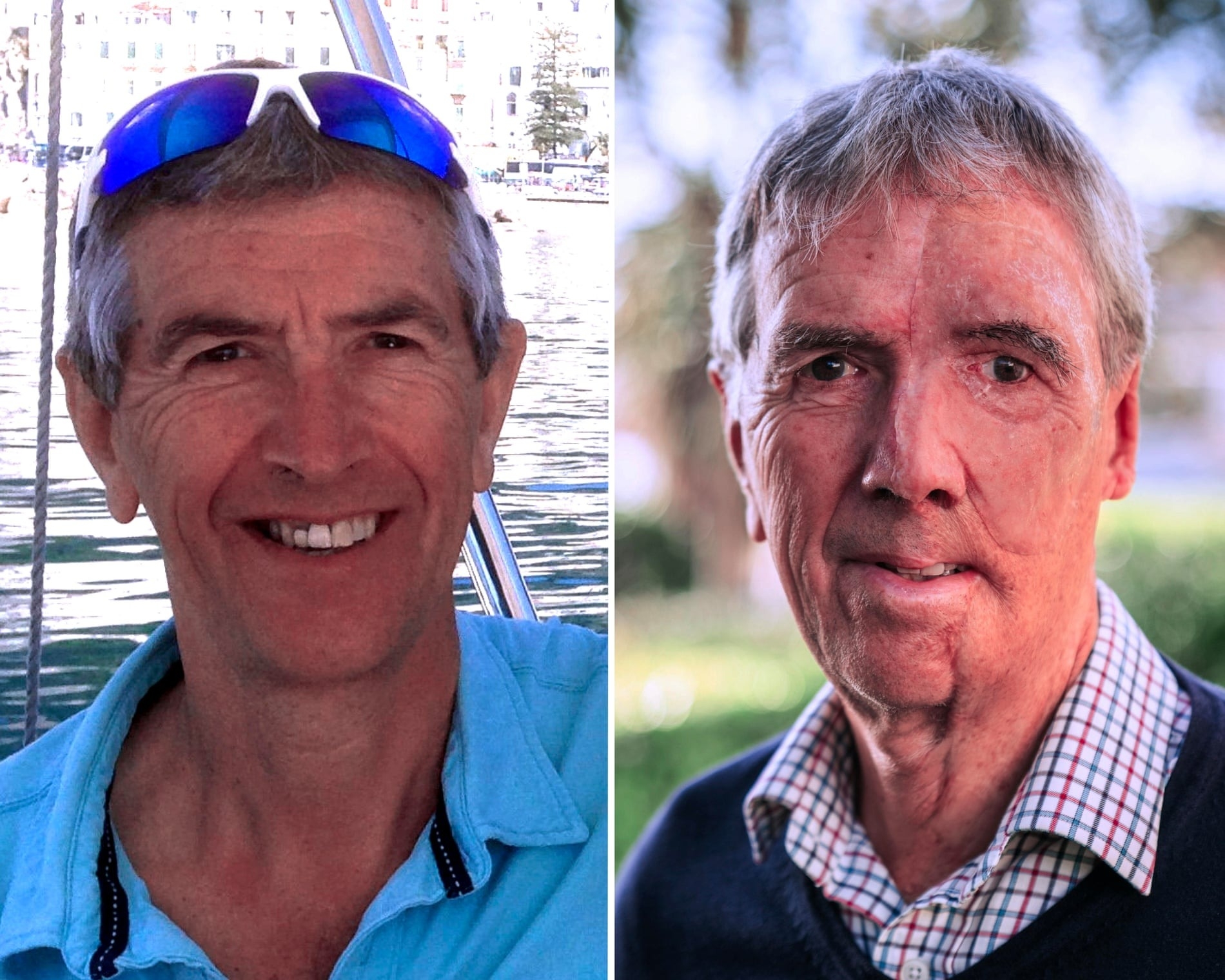 Visage imprime 3D 01