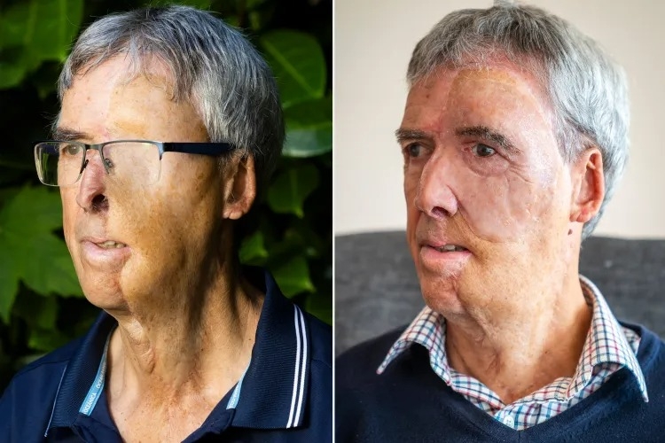 Visage imprime 3D 03