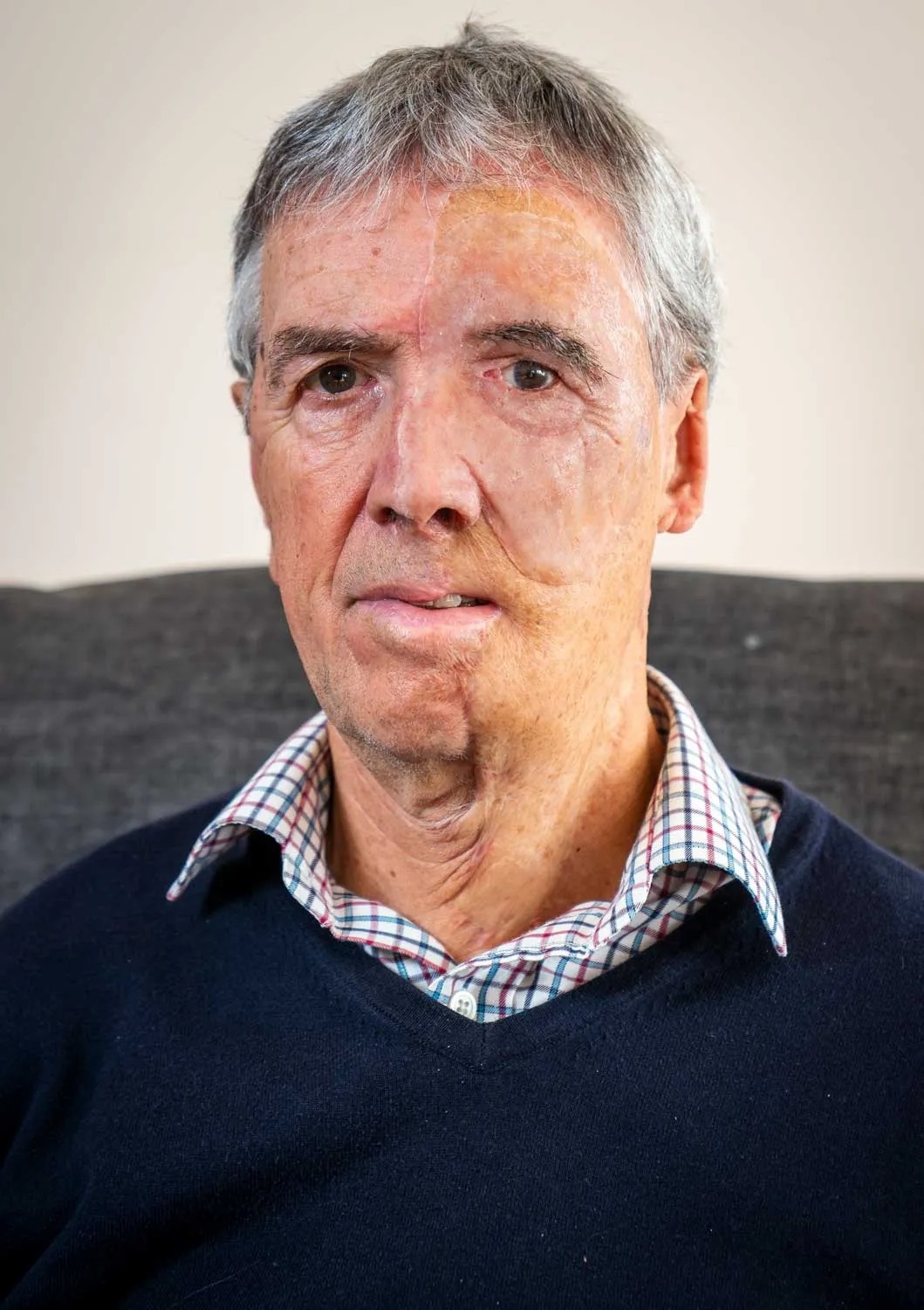 Visage imprime 3D 04